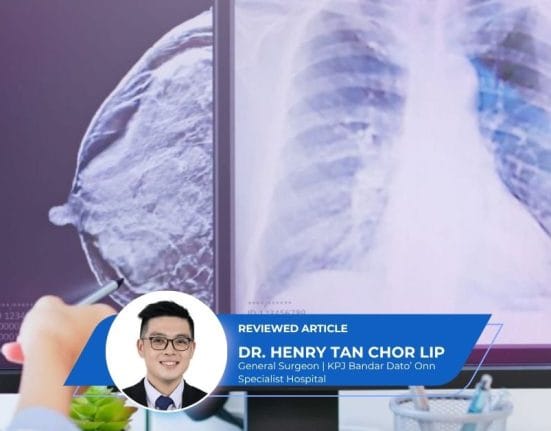Breast Cancer Surgery in Johor (1)