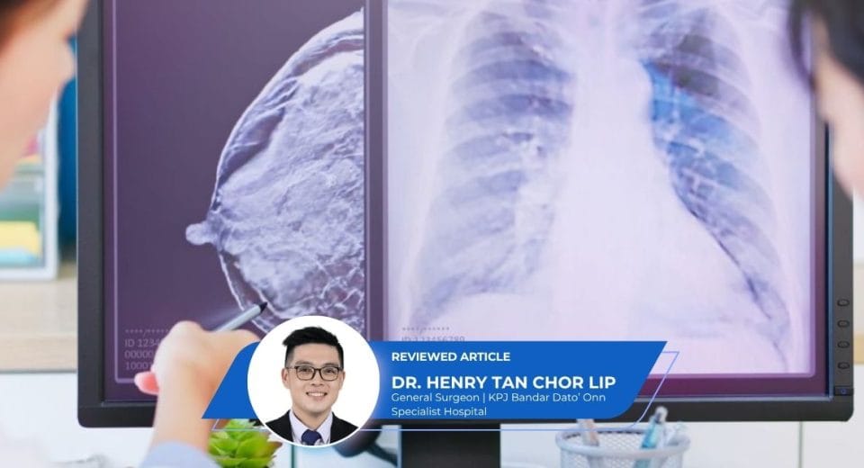 Breast Cancer Surgery in Johor (1)