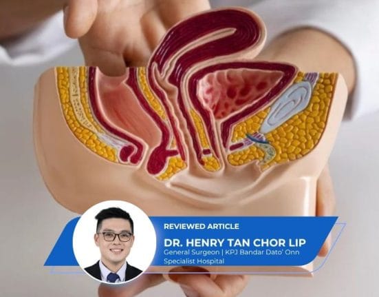 Colorectal Cancer Screening Myths (1)