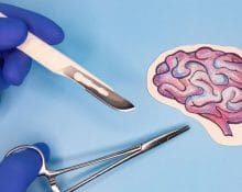 brain surgery cost in Malaysia