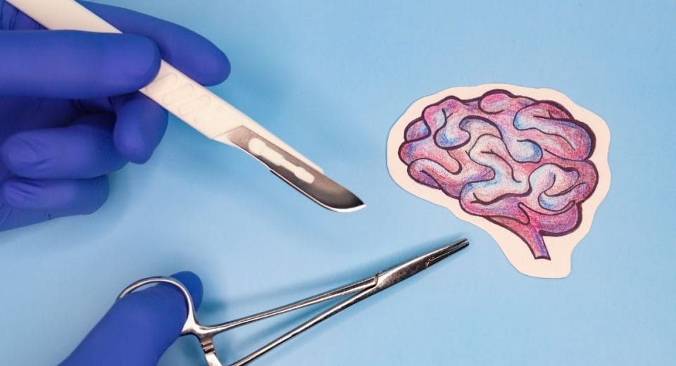 brain surgery cost in Malaysia