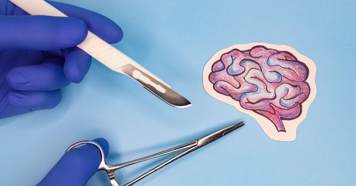 brain surgery cost in Malaysia