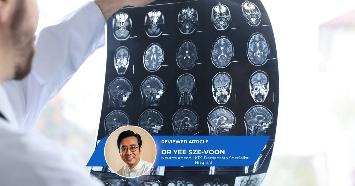 Abnormal Brain MRI or CT Findings