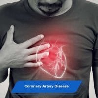 Coronary Artery Disease