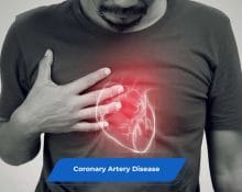Coronary Artery Disease