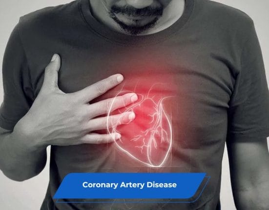 Coronary Artery Disease