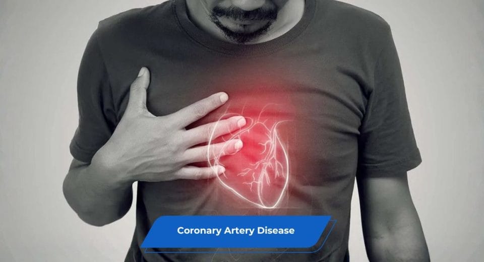 Coronary Artery Disease