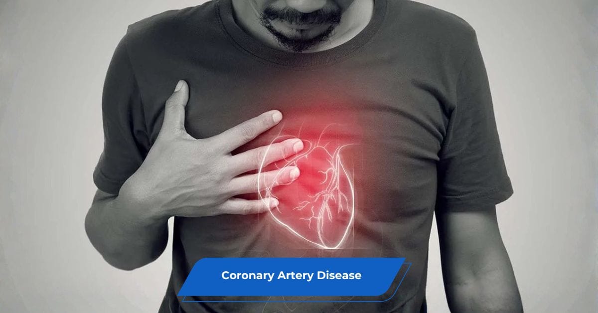 Coronary Artery Disease