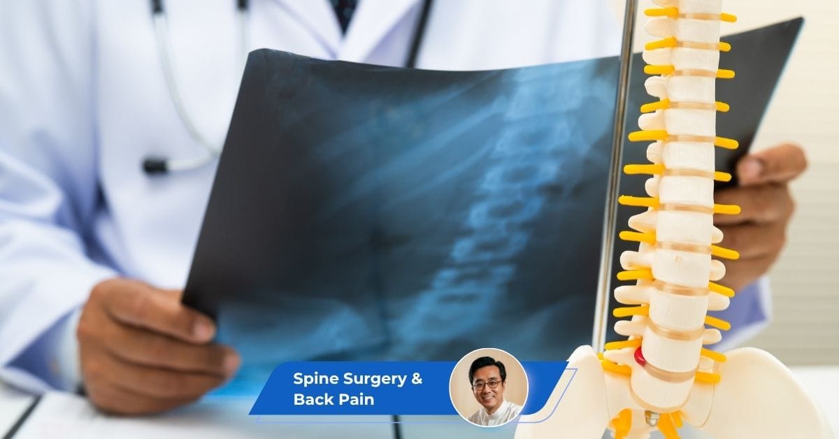 Endoscopic Spine Surgery & Minimally Invasive Back Pain Treatment Kuala Lumpur